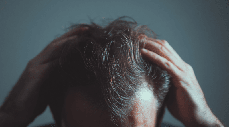 Bilden från Midcent visar en person som håller sitt huvud med händerna, vilket fångar en känsla av stress eller ångest. Detaljerna i håret och den koncentrerade uppmärksamheten riktar sig mot hälsa och välbefinnande. Bilden passar bäst in i kategorin Hälsa.